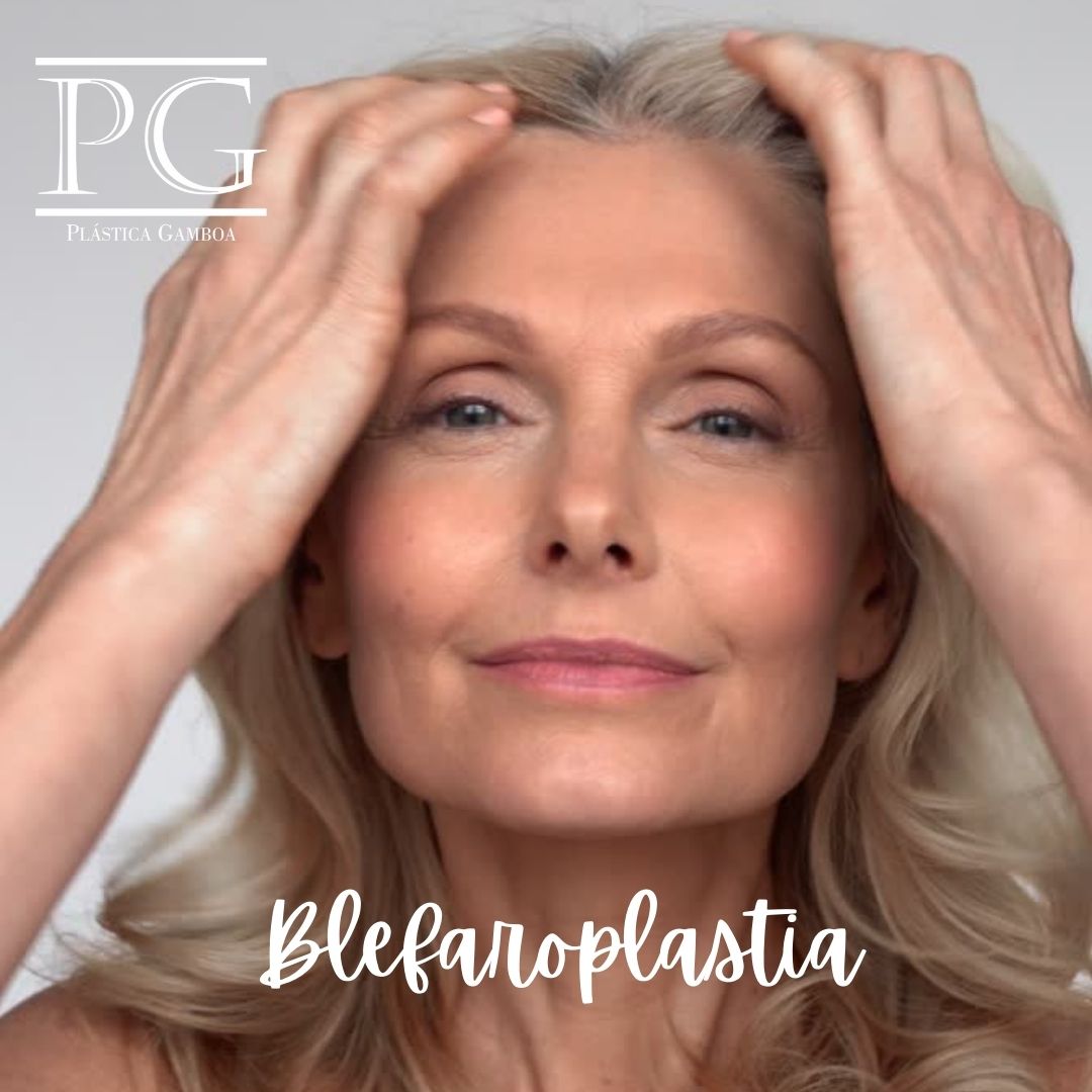 blefaroplastia