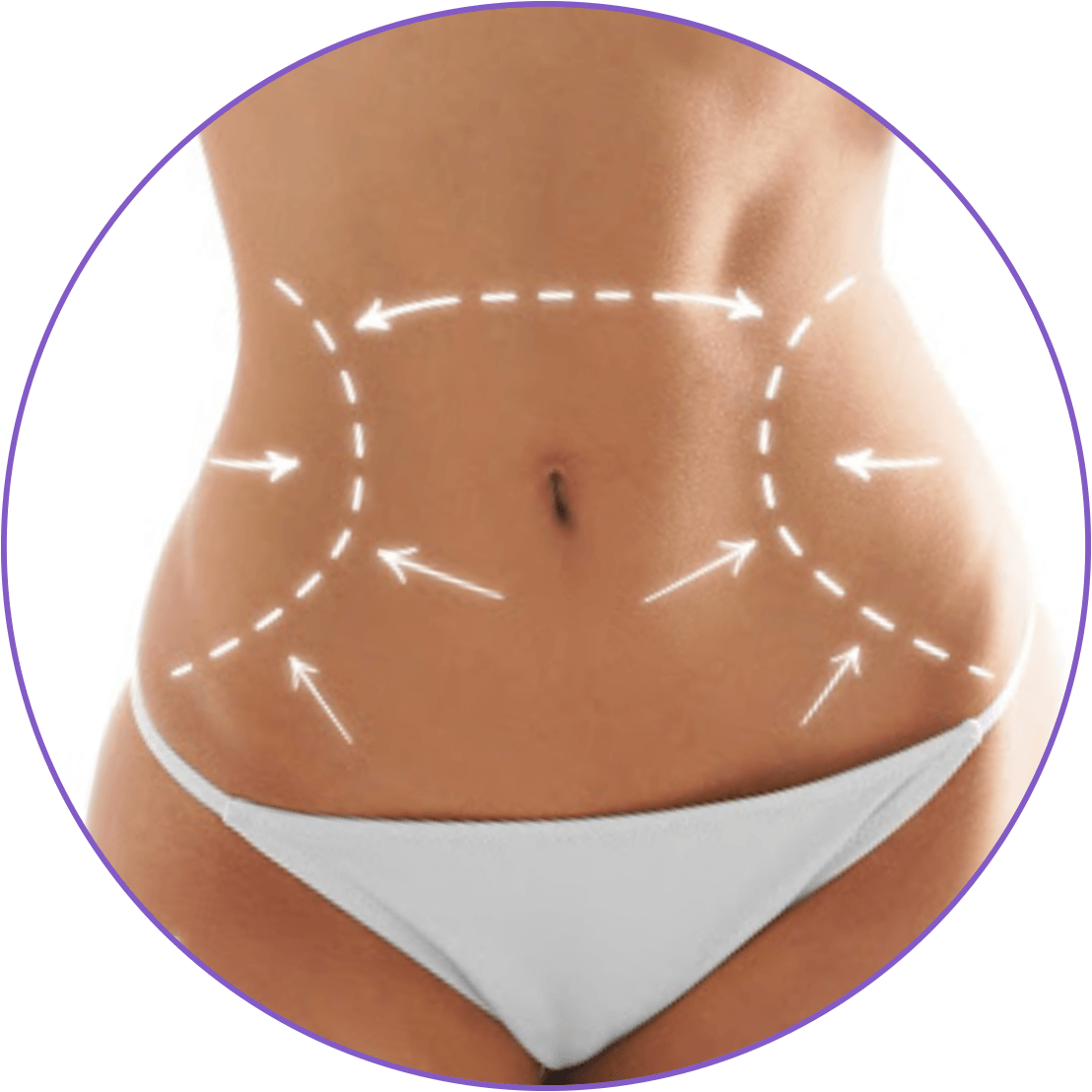 Abdominoplastia e Lipo-Abdominoplastia